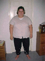 Pre-Op: 370 lbs