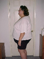 1 Month Post-Op
