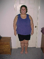 2 Month Post-Op
