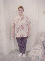 7 Month Post-Op